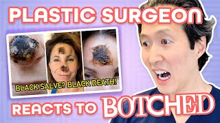 She Tried a DIY Treatment For Skin Cancer  BLACK SALVE  Plastic Surgeon Reacts to BOTCHED [upl. by Nnaes]