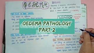 Oedema  Types Causes Symptoms amp Treatment  Part 2  Pathology [upl. by Eanaj]