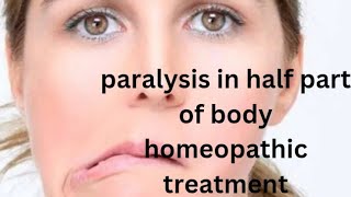 Paralysis affect on one side treatment in HOMEOPATHYmedicircle7553 [upl. by Mozelle]