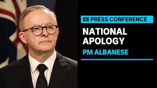 IN FULL Anthony Albanese delivers national apology to thalidomide survivors  ABC News [upl. by Zechariah619]