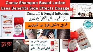 Conaz lotion how to useconaz lotion uses in urdu [upl. by Colombi]