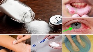 10 Unusual and Healthy Uses of Common Salt [upl. by Ximena255]