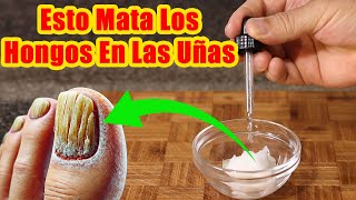 Esto MATA LOS HONGOS EN LAS UÑAS RAPIDAMENTE  Remedio Casero Para ELIMINAR HONGOS En Las Uñas [upl. by Cook169]