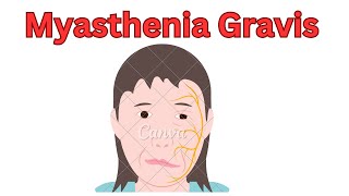 myasthenia gravis [upl. by Telford705]