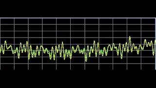 Nervous System Disorders  Rife Frequencies [upl. by Brice]