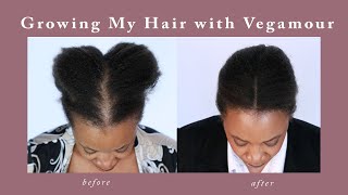 Vegamour Gro Advanced Hair Serum Results [upl. by Myrtle]