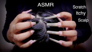 ASMR Fast Scratch itchy scalp So I Did Satisfying Scalp Scratching  No Talking [upl. by Cinimod]