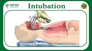 Intubation What is Intubation What conditions require Intubation Types of Intubation [upl. by Fisk851]