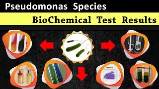 Pseudomonas Biochemical test results [upl. by Sirmons]