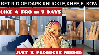 GET EVENTONE KNUCKLE KNEE amp ELBOW WITH THIS SIMPLE METHOD skincareroutine skintreatment [upl. by Ynohtnael]