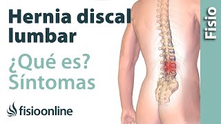 Hernia discal o de disco lumbar  Qué es causas síntomas y tratamiento [upl. by Olegna]