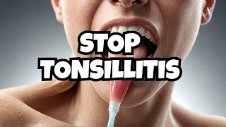 Causes Of Tonsillitis And Bad Breath That Shocked Me [upl. by Lorena]