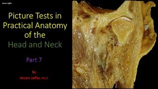 Picture tests in head and neck anatomy 7 [upl. by Einnob]