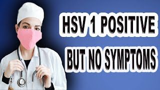 Hsv1 Positive But No Symptoms [upl. by Ativad]