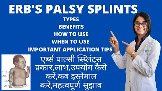 Video 5 ERBS PALSY ELBOW SPLINTS TYPES BENEFITS HOW amp WHEN TO USE APPLICATION TIPS DR PRIYANKA [upl. by Sharpe]