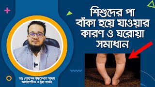 শিশুদের পা বাঁকা হয়ে যাওয়ার কারণ ও ঘরোয়া সমাধান। [upl. by Arliene]