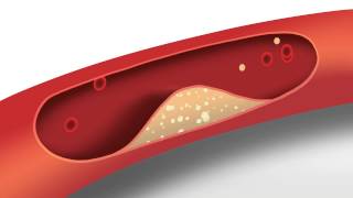 Blood Pressure Animation  Heart disease risk factors [upl. by Gere]