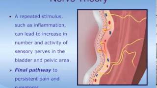 Understanding Interstitial Cystitis ICPainful Bladder Syndrome PBS [upl. by Rusticus]