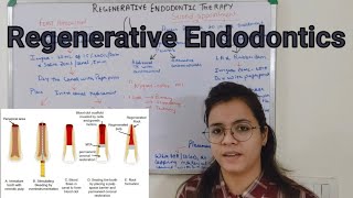 Regerative Endodontic Therapy  Revascularisation [upl. by Alrahc]