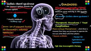 NCLEX Review on GuillainBarre Syndrome [upl. by Regdor954]