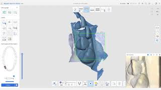 Réaliser simplement vos couronnes sous châssis  MEDIT LINK TUTORIEL [upl. by Wayolle]