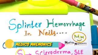 Mnemonic For Causes of Splinter fingernailSplinter Hemorrhages For NEETPGUSMLE Step 1 Prep [upl. by Ignacia]