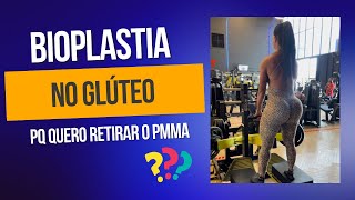 Tudo sobre minha Bioplastia no Glúteo respondendo as dúvidas de vocês [upl. by Amling202]