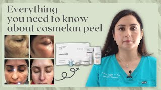 COSMELAN PEEL  SENIOR PRACTITIONERS GUIDE TO Hyperpigmentation treatment [upl. by Navert]