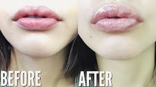 HOW TO GET BIGGER LIPS NATURALLY WITHOUT MAKEUP [upl. by Favien156]