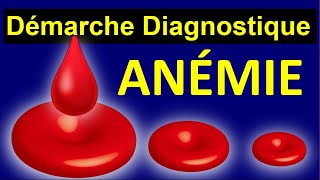 Diagnostique des Anémies Causes Megaloblastique par Carence Arégénérative Hémolytique Auto immune [upl. by Garson]