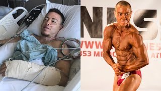 Trans Bodybuilder Has Phalloplasty Surgery  MY TRANS LIFE [upl. by Ltsyrk]