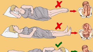 Wrong Sleeping Positions For Pregnant Women Harm the Fetus  Best Sleeping Position during Pregnancy [upl. by Hirz]