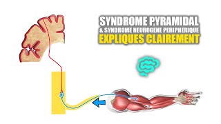 🔴 Syndrome pyramidal VS syndrome neurogène peripherique Expliqués Très Clairement par Dr Astuce [upl. by Cirek]