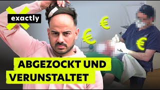 Pfusch und Betrug Das Geschäft mit dem Haarausfall  Doku  exactly [upl. by Khalsa]