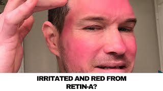 HOW TO CALM DOWN RETINA IRRITATION AND REDNESS [upl. by Blossom]