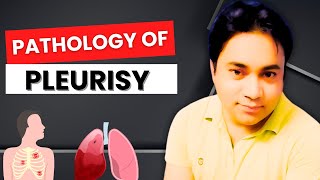 Pathology Of Pleurisy  By DrJaved Sir  DJMC [upl. by Naegem]