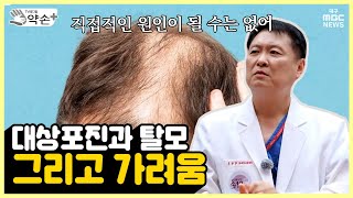 대상포진과 탈모 그리고 가려움 통증의 공포 대상포진⑨  메디컬 약손 [upl. by Matusow671]