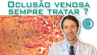 Oclusão venosa da retina sempre necessita tratamento [upl. by Goldston]