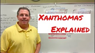 Xanthoma A Simple Explanation [upl. by Deer]