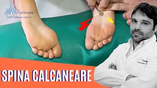 Spina calcaneare  Forse non è lei la Causa del Dolore [upl. by Morgana]