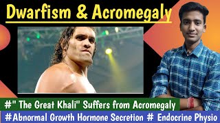 Acromegaly amp Dwarfism amp Gigantism  Growth HormoneEndocrine Physiology  in hindi Ashish [upl. by Ecadnac]