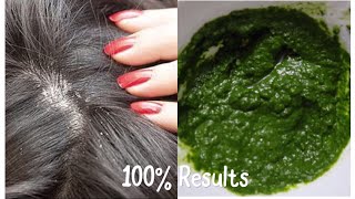 BEST SEBORRHEIC DERMATITIS SCALP TREATMENT  AYURVEDIC DANDRUFF TREATMENT 100 RESULTS IN ONE USE [upl. by Yelhak]