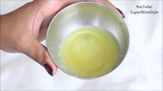 Get Rid of dandruff in 1 Day  Instant Dandruff Remedy at Home [upl. by Eire]