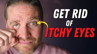 BEST 5 Tips For Red Itchy Eyes From Eye Allergies [upl. by Carmela]