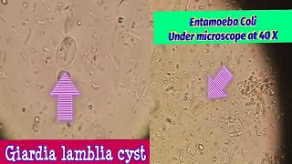 Difference between Giardia Lamblia amp Entamoeba Coli cystBest view under microscope at 40 X [upl. by Monafo]