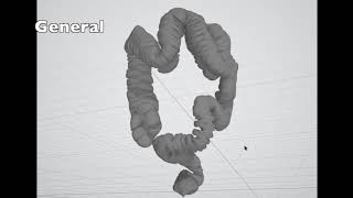 3D Colon Anatomy for Endoscopists [upl. by Erelia264]