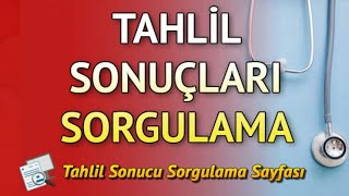 Tahlil Sonuçlarını Nasıl Öğrenebilirim [upl. by Yesac]