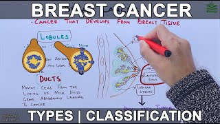 Carcinoma of male breast clinical presentation treatment [upl. by Mazurek]