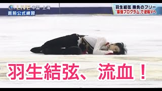 羽生結弦、流血！ 中国選手との衝突の瞬間！！ [upl. by Elyr719]