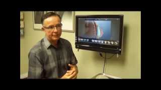 Breast Implant Placement Under or Over The Muscle [upl. by Sheryl]